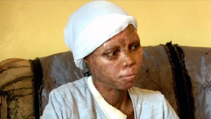 Man Admits to Pouring Acid on Woman During Court Hearing