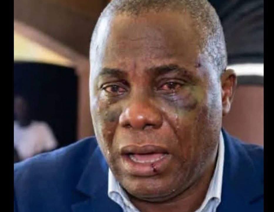 Muwanga Kivumbi On His Death Bed In SFC Barracks, Tortured And Bleeding – Bobi Wine Confirms